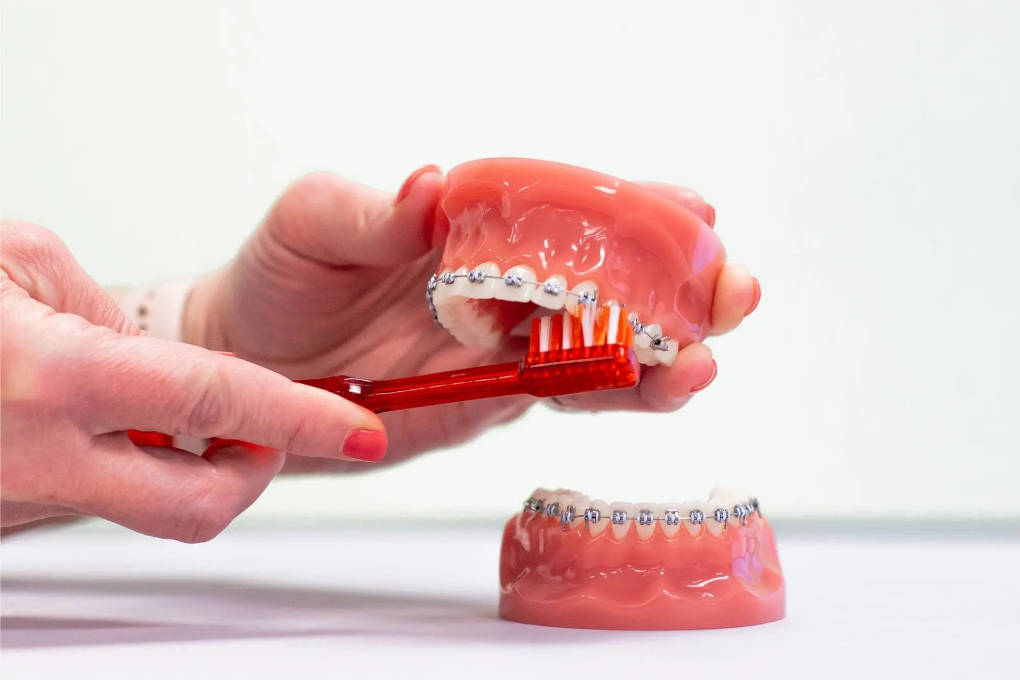 How to Brush Your Teeth with Braces