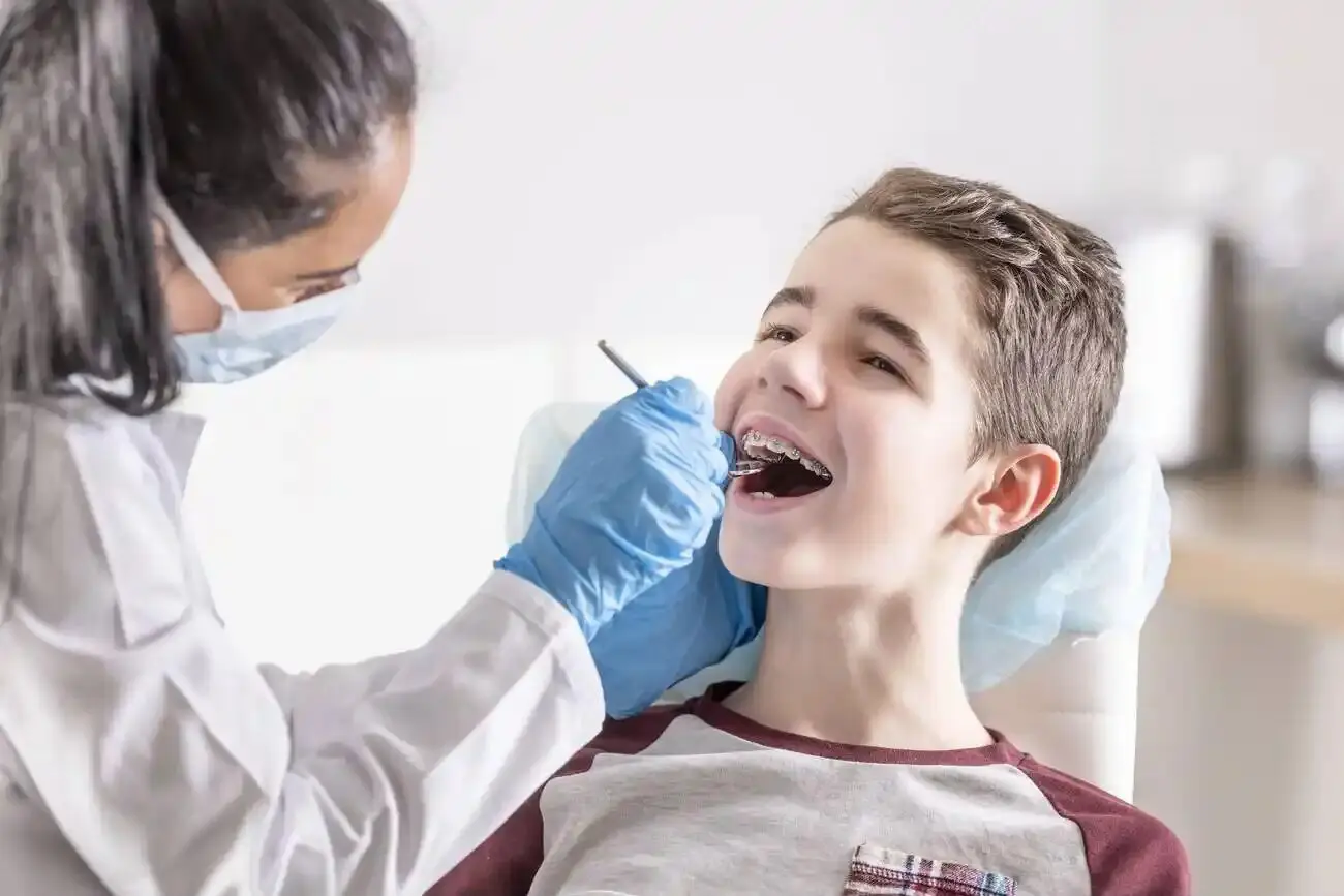 When Do Kids Get Braces? The Ultimate Guide for Parents