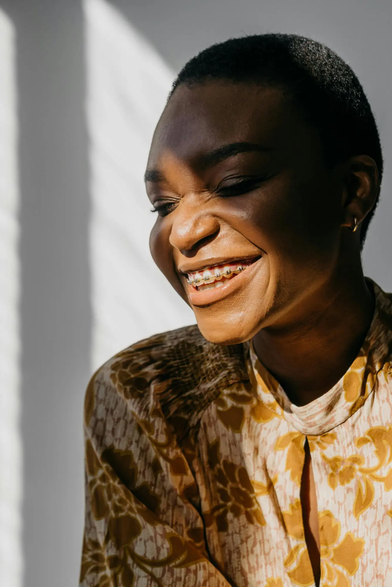 How Long Do Braces Take? Find Out Here – Expert Guide