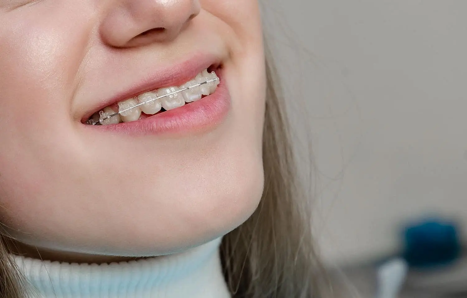 A close-up of a smiling mouth with clear ceramic braces, highlighting a discreet orthodontic option. Limestone Hills Orthodontics in Austin, TX, provides ceramic braces for adult patients.