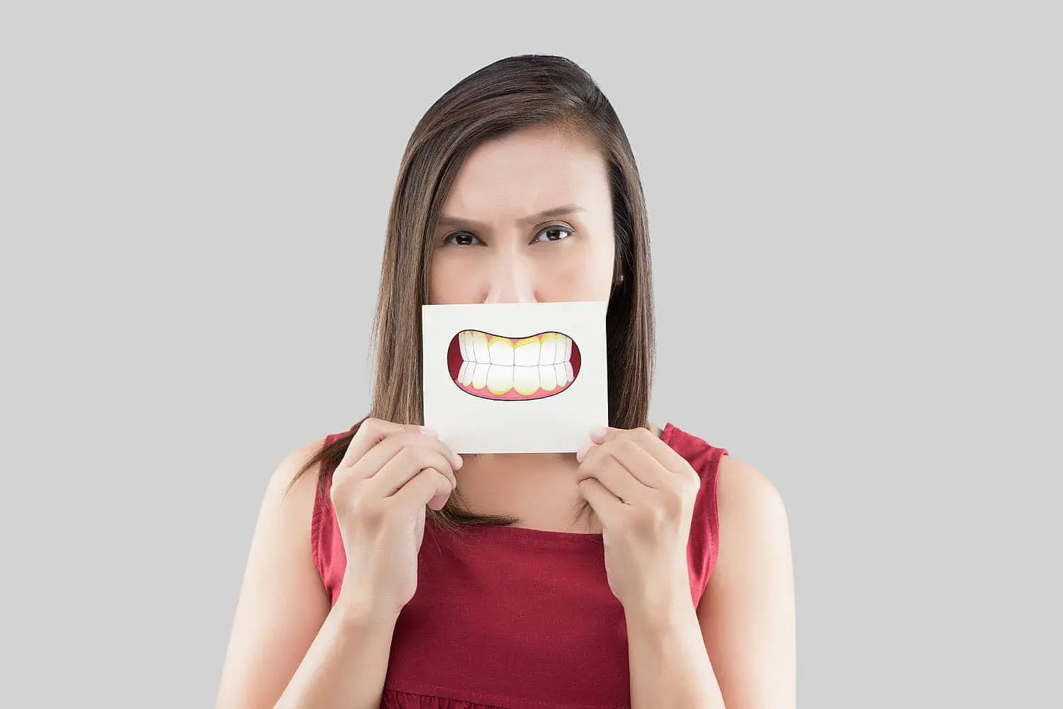 Illustration showing underbite at Limestone Hills Orthodontics in Austin, TX.