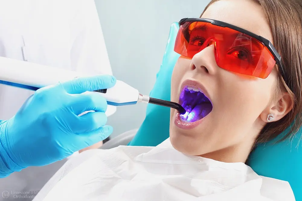 light curing seals the woman at the orthodontist - Why Your Child Should Have Two-Phase Orthodontic Treatment in Austin, TX